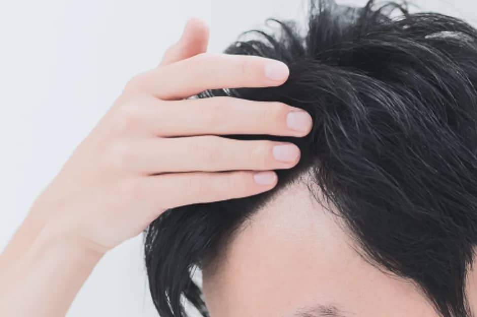 Scalp Type Check