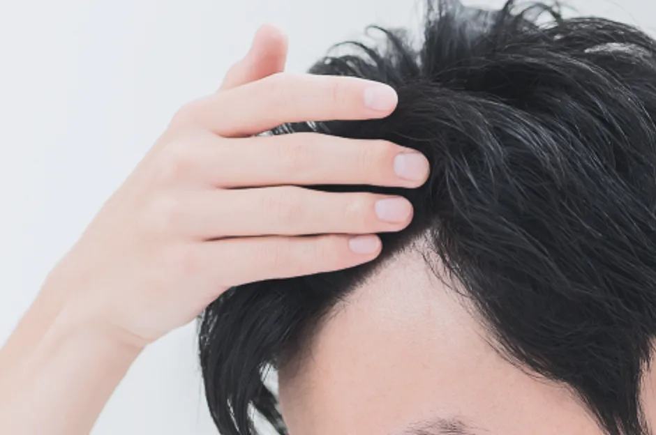 Scalp Type Check