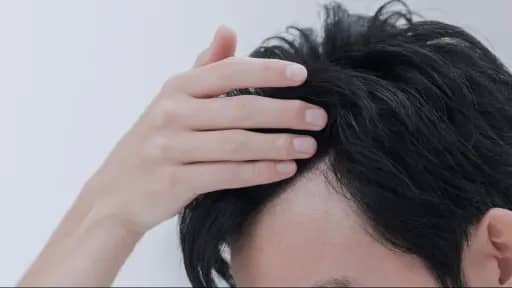 頭皮タイプチェック