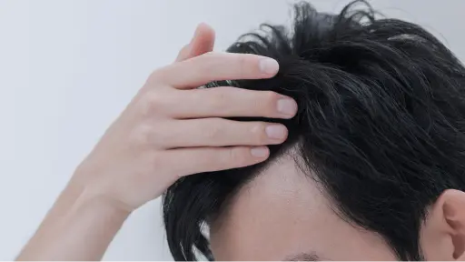 頭皮タイプチェック