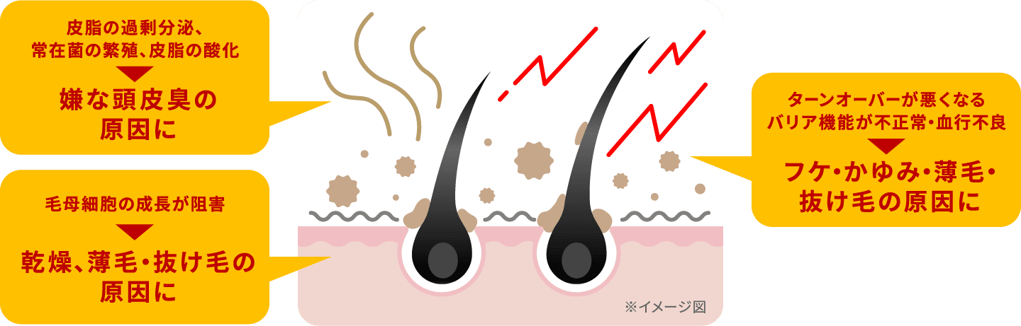 嫌な頭皮臭の原因に フケ・かゆみ・薄毛・抜け毛の原因に 乾燥、薄毛・抜け毛の原因に